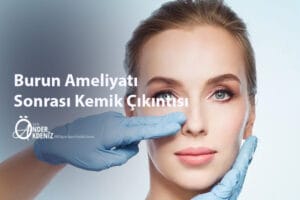 Burun Ameliyatı Sonrası Kemik Çıkıntısı