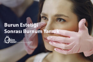 Burun Estetiği Sonrası Burnum Yamuk