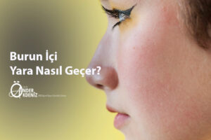 Burun İçi Yara Nasıl Geçer
