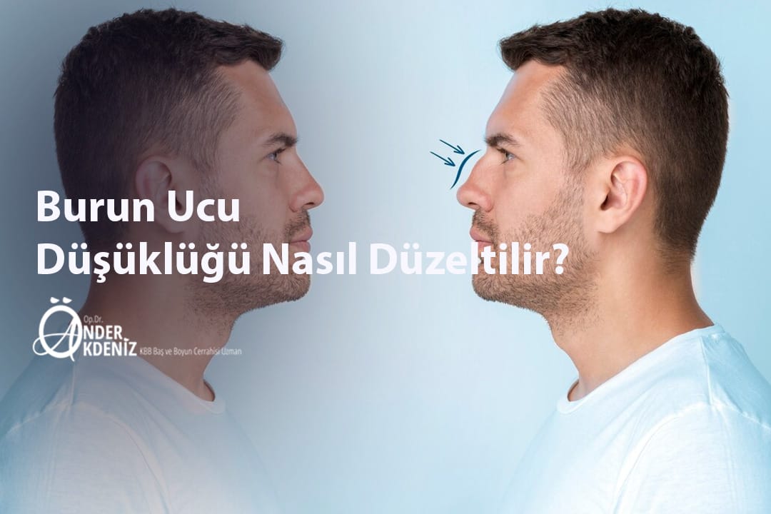 Burun Ucu Düşüklüğü Nasıl Düzeltilir