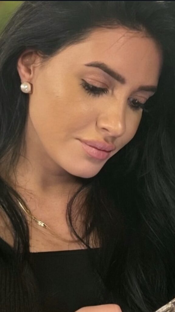 Bursa Rhinoplasty After Photo 2