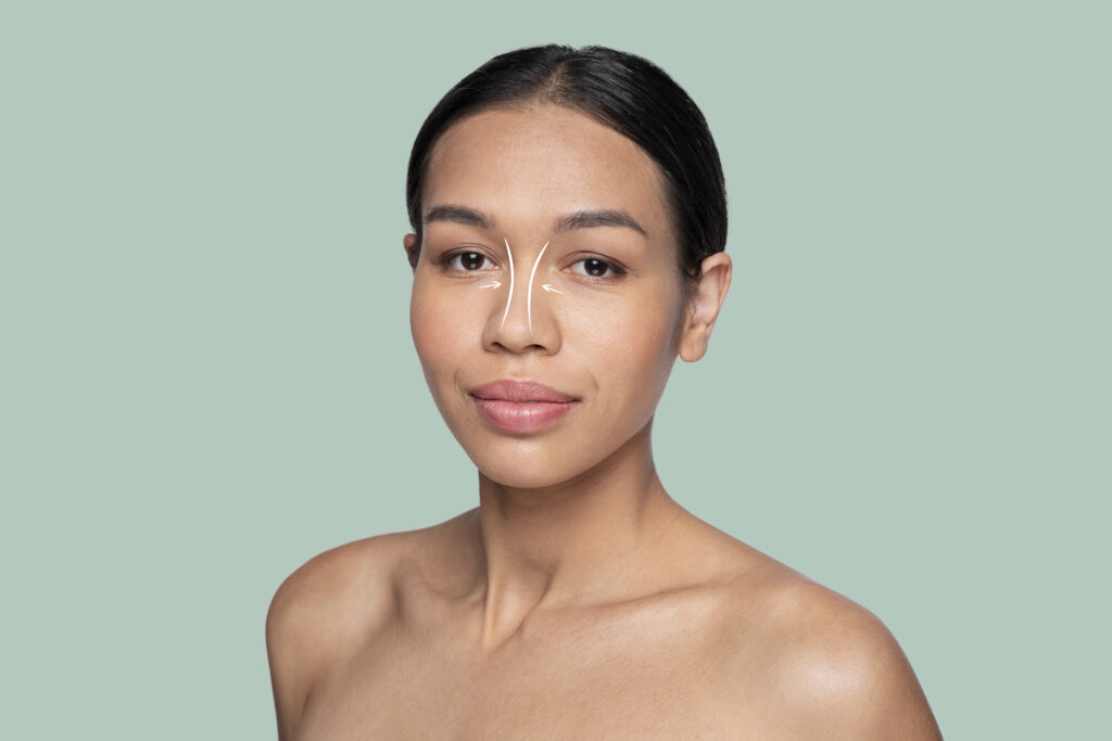 kalın derili burun estetigi