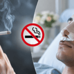Sigara ve Burun Estetiği İyileşme Süreci