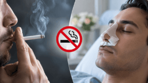 Sigara ve Burun Estetiği İyileşme Süreci