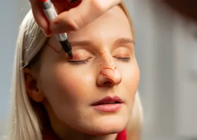 Bursa Revizyon burun estetigi