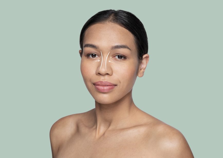 kalın derili burun estetigi